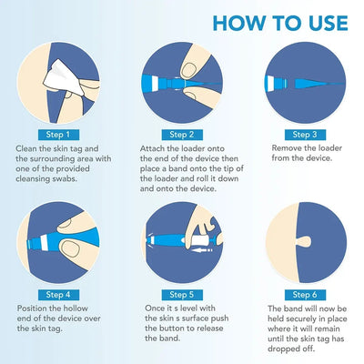 2-in-1 Auto Micro Skin Tag Remover Device